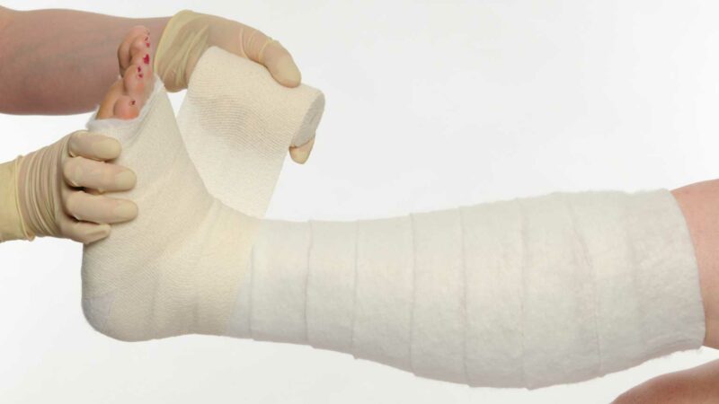 Person bandaging someone's foot and lower leg
